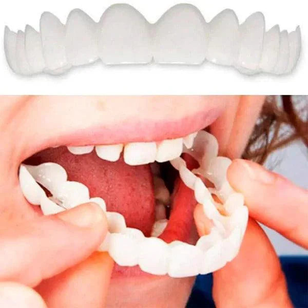 Smile Pro® - Carillas Dentales Removibles | Inferior y Superior.